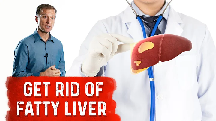 Reduce your liver fat by 50% in 14 days