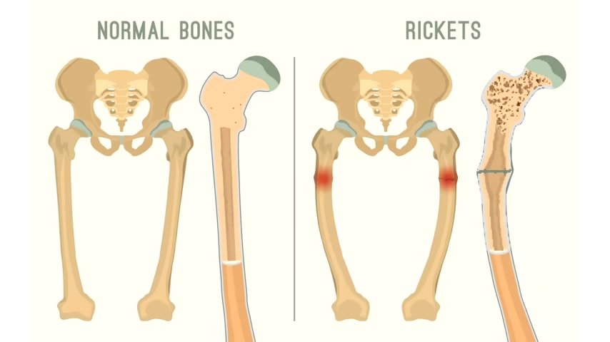 prevent rickets .