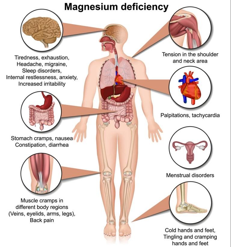 Magnesium deficiency symptoms