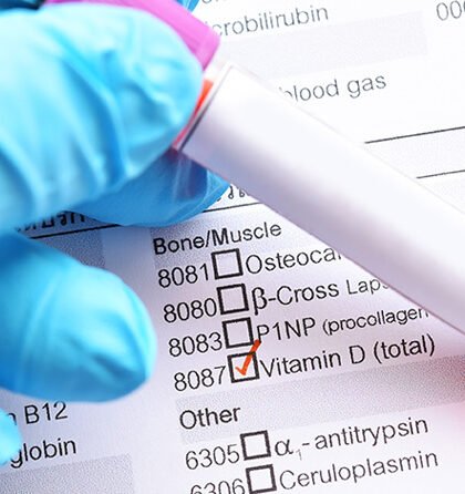 Normal Vitamin D Levels