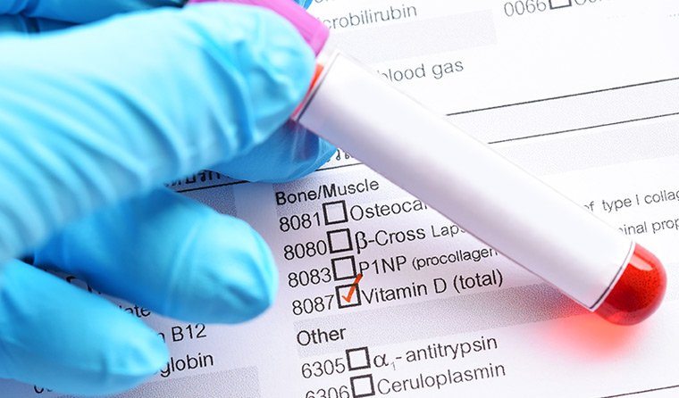 Normal Vitamin D Levels