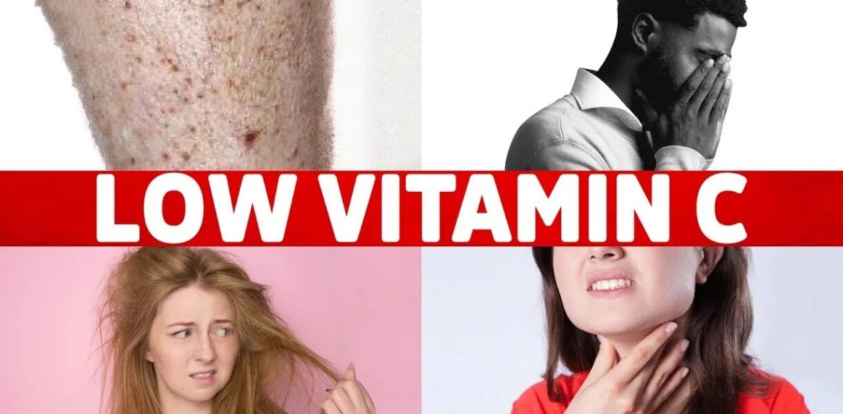 8 Signs of a Vitamin C Deficiency You've Never Heard About