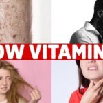 8 Signs of a Vitamin C Deficiency You've Never Heard About