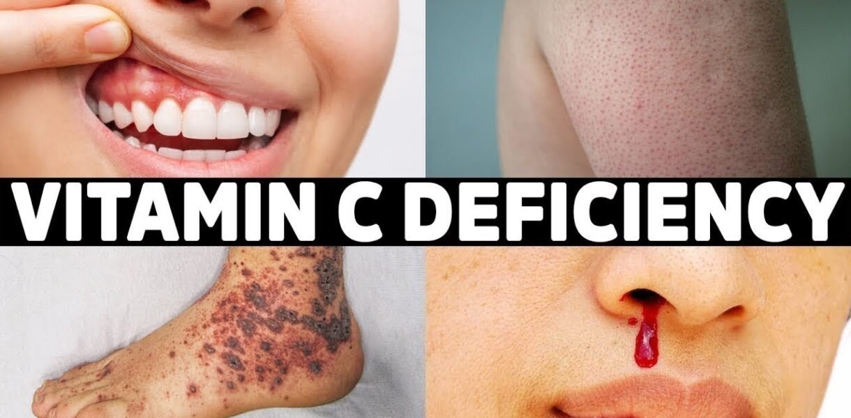 The 7 Signs You're Not Getting Enough Vitamin C