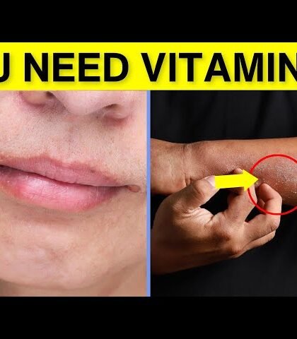 11 Vitamin B6 Deficiency Symptoms You've Never Heard Before