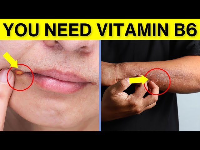 11 Vitamin B6 Deficiency Symptoms You've Never Heard Before