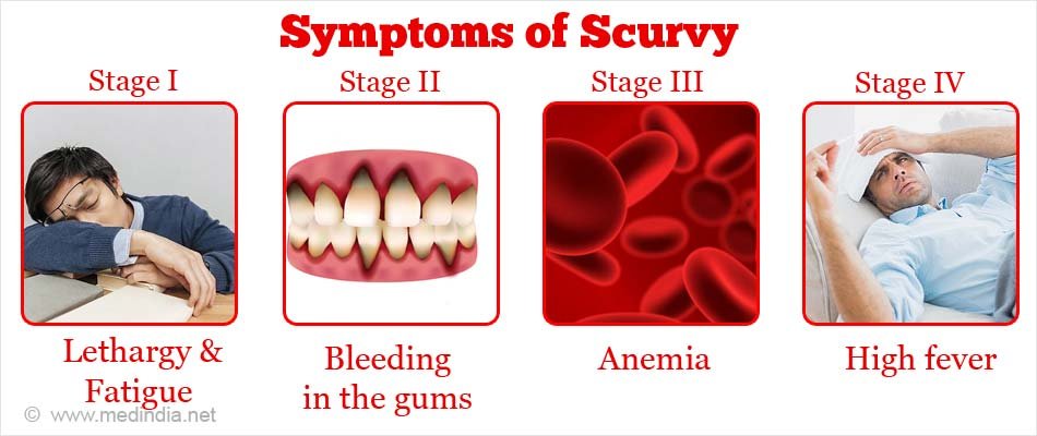 Vitamin C Deficiency (Subclinical Scurvy)