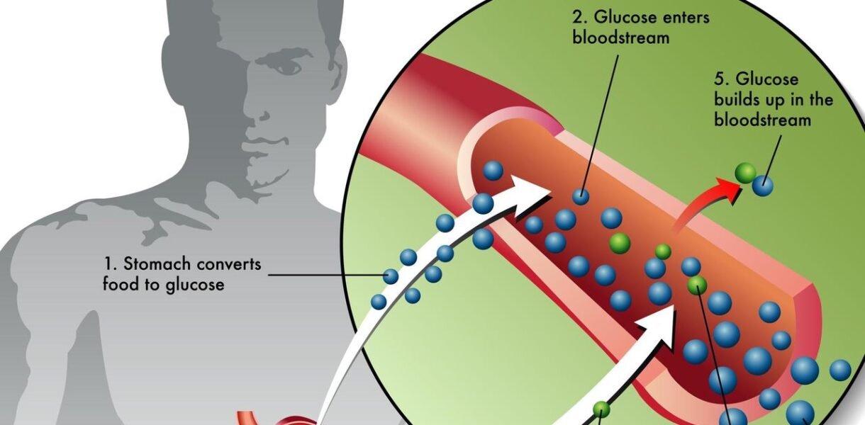 Type 1 Diabetes : Insulin And Potassium