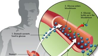 Type 1 Diabetes : Insulin And Potassium