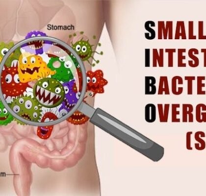 SIBO: How It Steals Your Nutrients and 5 Effective Solutions