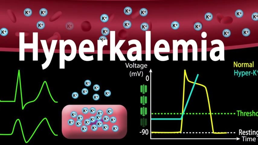 hyperkalemia 