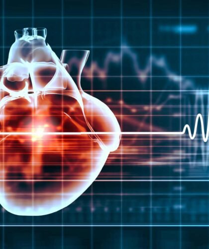 Heart Rate Variability (HRV)