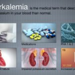 Hyperkalemia (High Potassium Levels)-Symptoms & Treatment