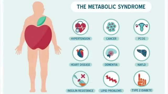  metabolic syndrome