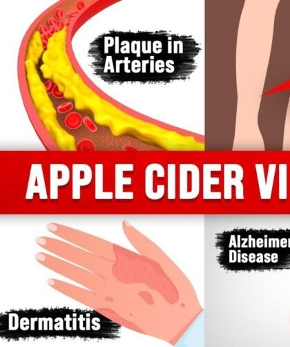 9 Unexpected Amazing Benefits of Apple Cider Vinegar