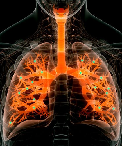 Zinc and Lungs: Zinc Effects on Your Respiratory System