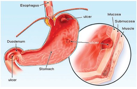 Side Effects of Zinc Deficiency: Beyond Tissue Healing