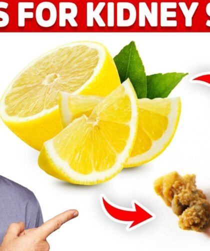 How does Lemon Juice Dissolve Kidney Stones?